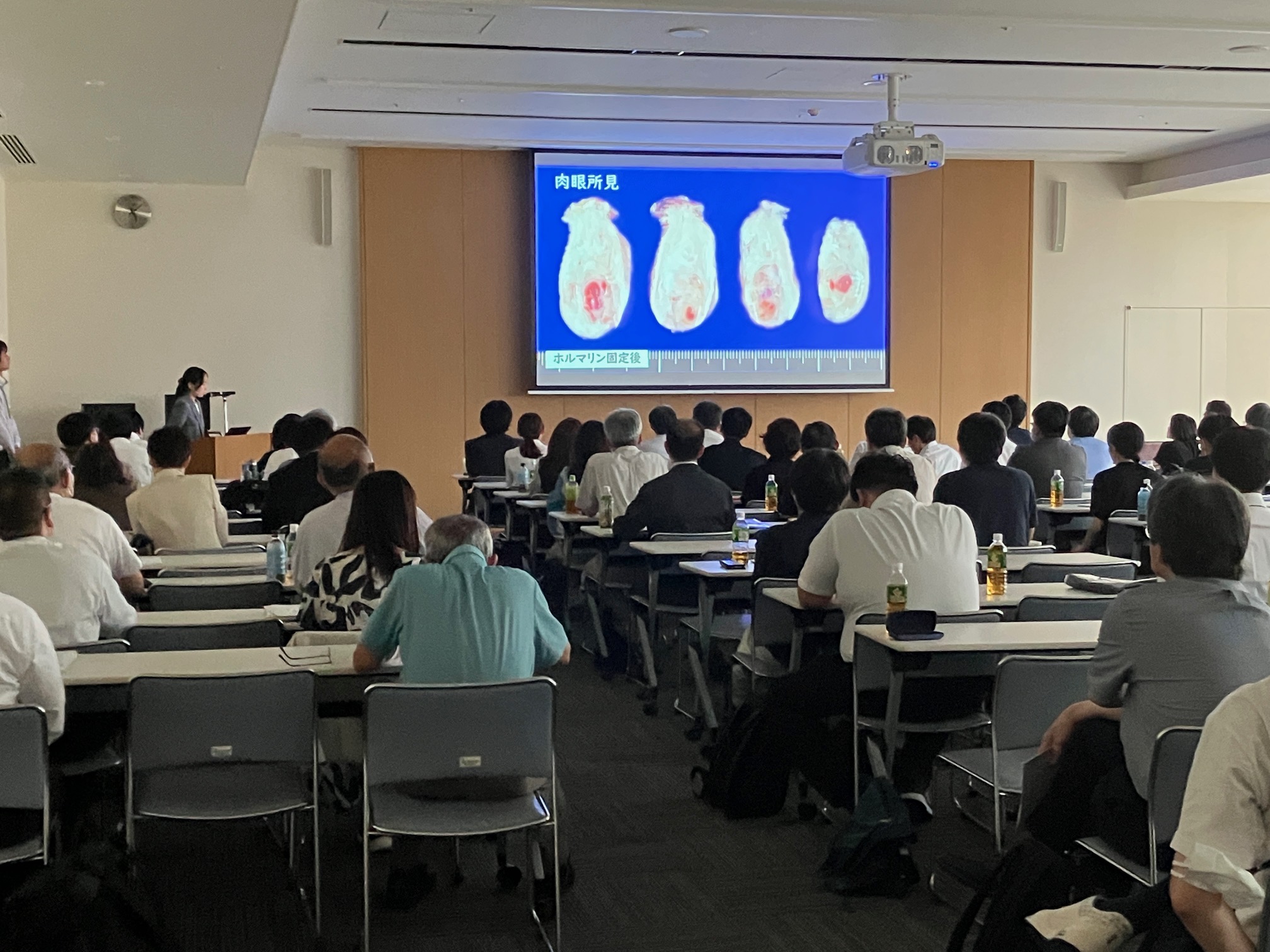 第150回日本病理学会中国四国支部学術集会で発表する志田美菜医師